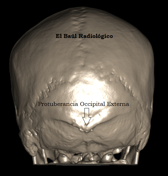 ganglio occipital inflamado tratamiento